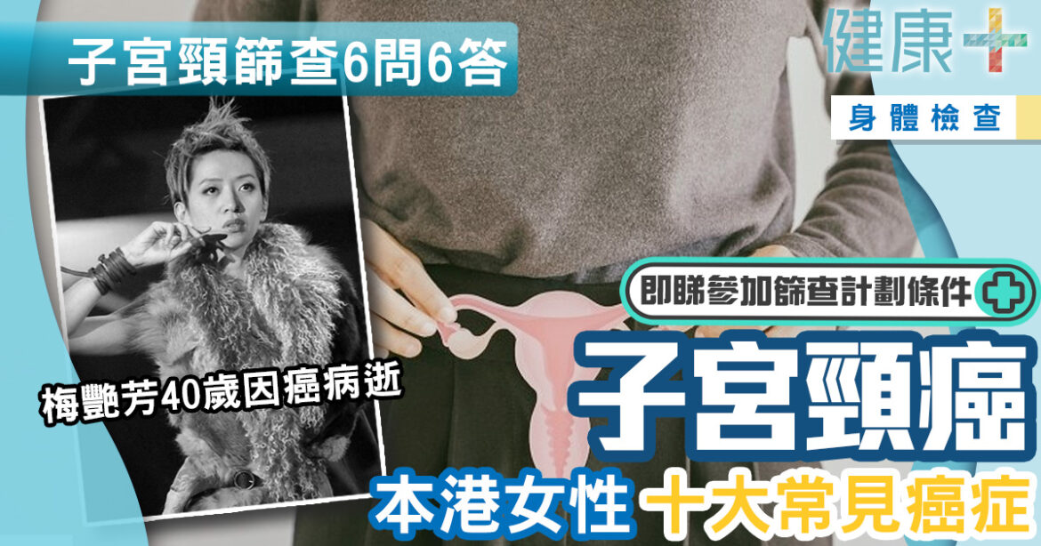 婦女健康｜本港女性十大常見癌症：子宮頸癌　定期做子宮頸篩查預防病發