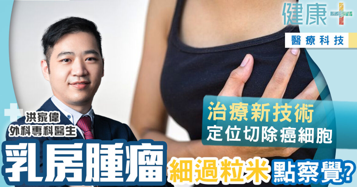 癌症治療｜摸不到的乳房腫瘤如何治療？治療新技術定位切除癌細胞