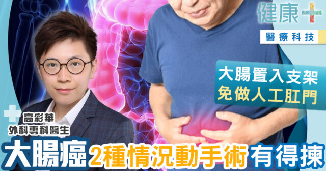 健康-醫療科技-疾病資訊-癌症-大腸癌