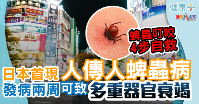 遊日注意|日本現人傳人蜱蟲病首例 春天小心蜱蟲叮咬4步自救 健康-疾病資訊-遊日注意-蜱蟲傳染病-SFTS