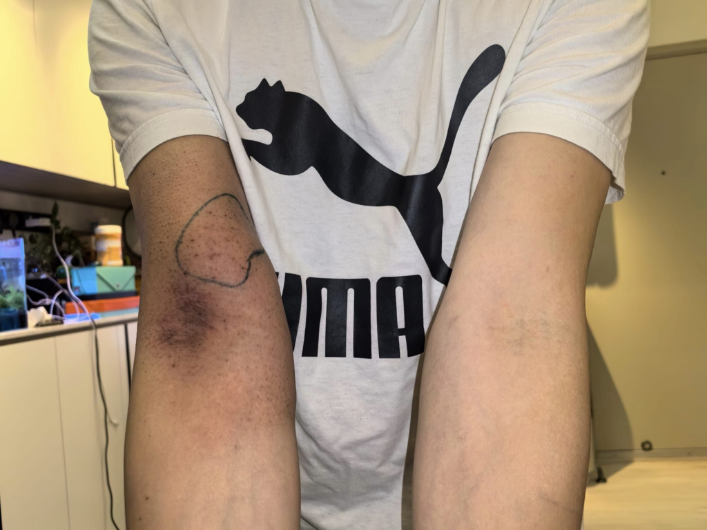 健康-疾病資訊-癌症-天瑜爸爸