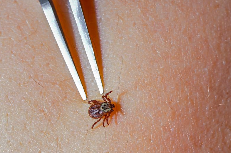 健康-疾病資訊-遊日注意-蜱蟲傳染病-sfts