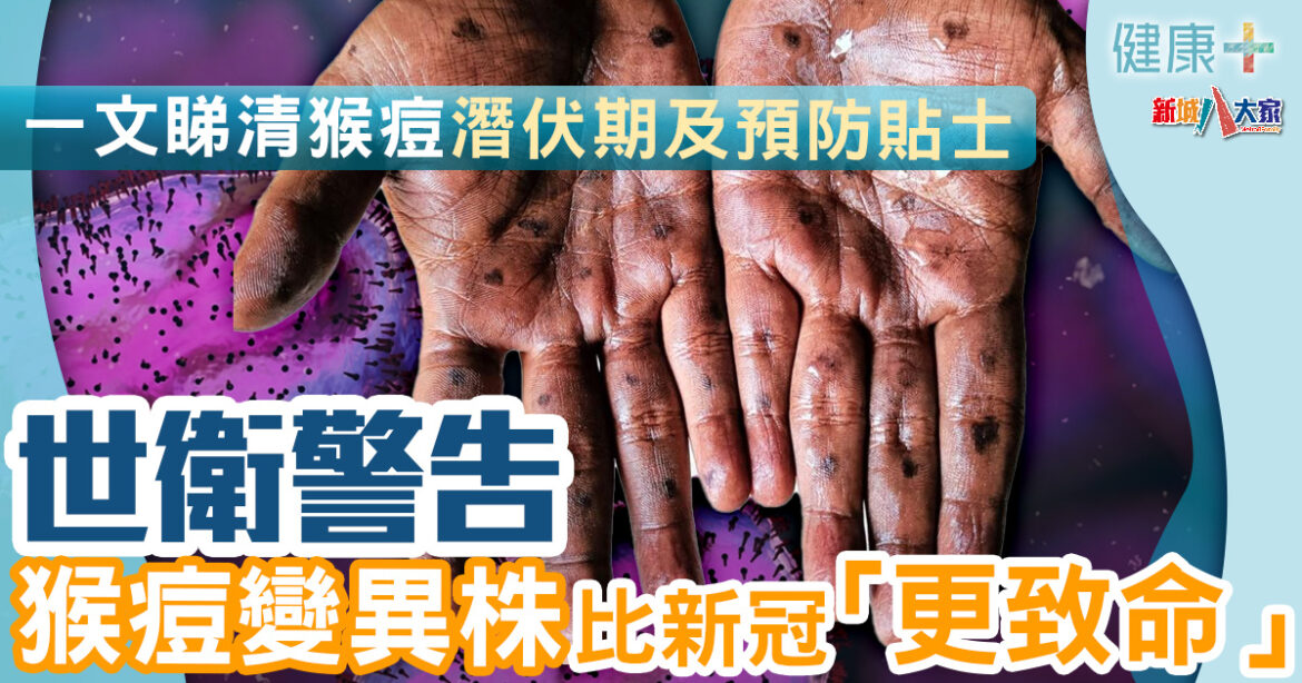 猴痘警號｜WHO警告猴痘變異株比新冠疫情「更致命」　一文睇清猴痘潛伏期及預防貼士
