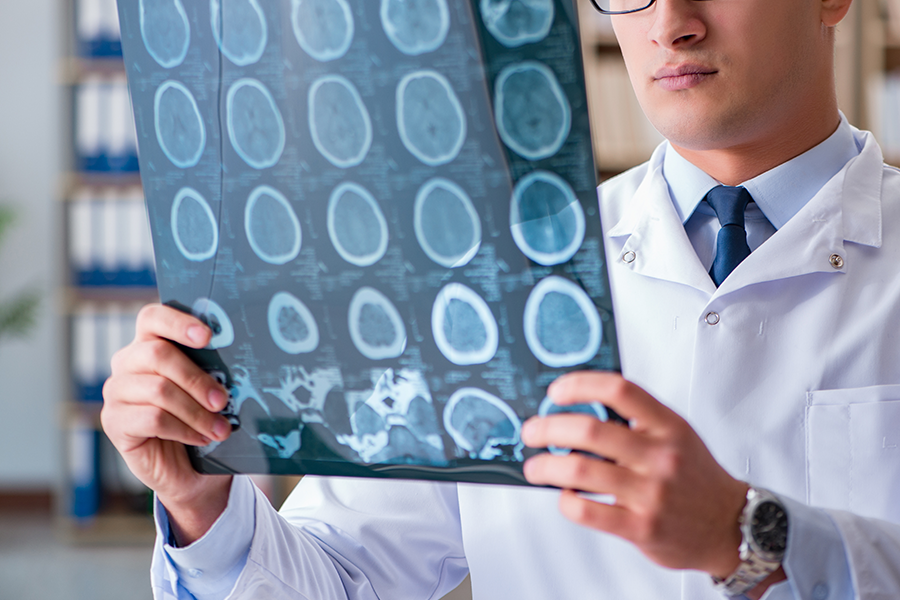 健康-中醫養生-中西醫協作-中風先兆-眩暈-手痹