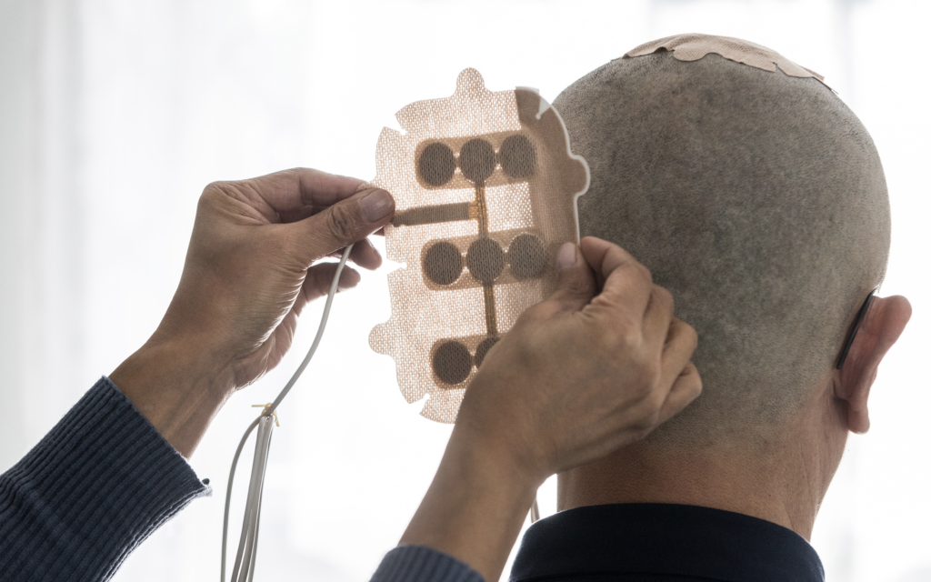 健康-醫療科技-癌症治療-電場治療