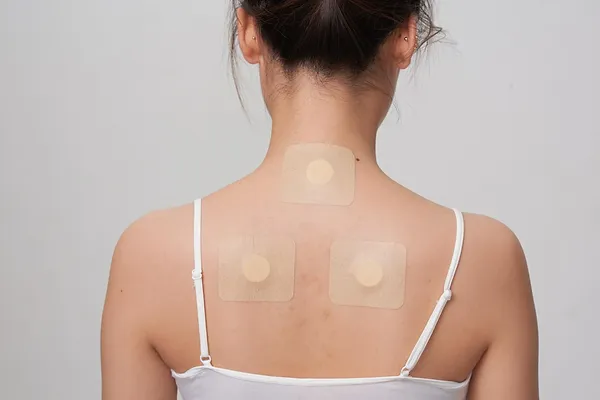 健康-中醫養生-鼻敏感-天灸療法-三伏天