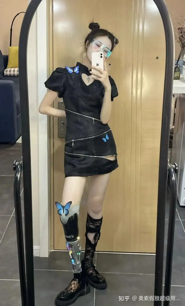 汶川地震-倖存者-感人故事-成長-截肢1