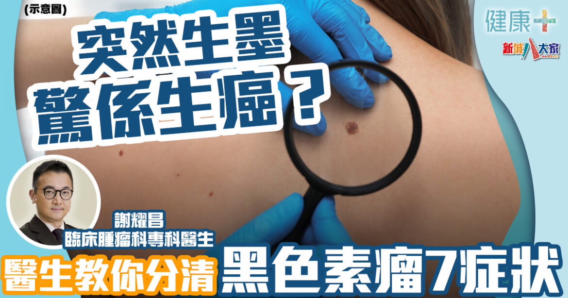 預防癌症丨身上突然生墨恐生癌？醫生教你分清黑色素瘤7症狀