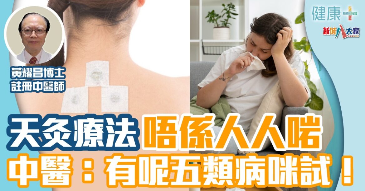 天灸療法唔係人人啱  中醫：有呢五類病咪試！