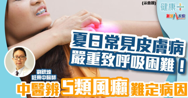 中醫調理|夏日常見皮膚病嚴重致呼吸困難!中醫辨5類風癩難定病因 健康-疾病資訊-中醫調理-皮膚健康-風癩-癮疹