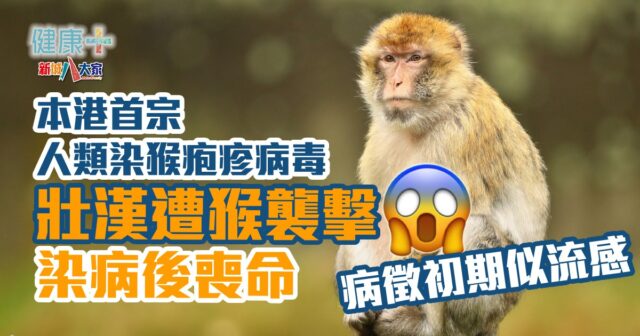 本港首宗人類染猴疱疹病毒 壯漢遭猴襲擊染病後不治 健康-疾病資訊-行山-猴疱疹病毒