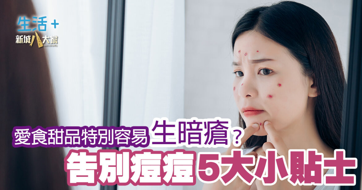 愛食甜品特別容易生暗瘡？ 告別痘痘5大小貼士