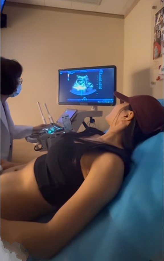 娛樂-coffee林芊妤-t21檢查-染色體13異常