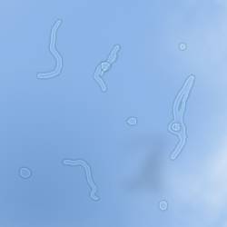 健康-疾病資訊-飛蚊症