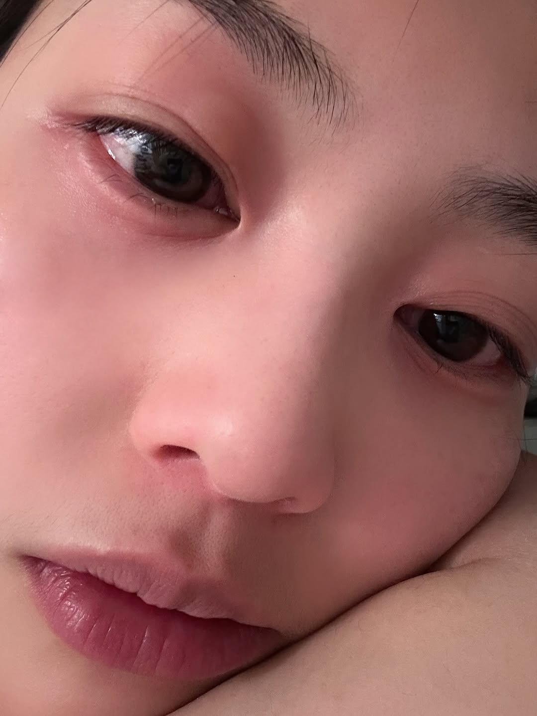 娛樂-郭柏妍-食物中毒-食物敏感-致敏原