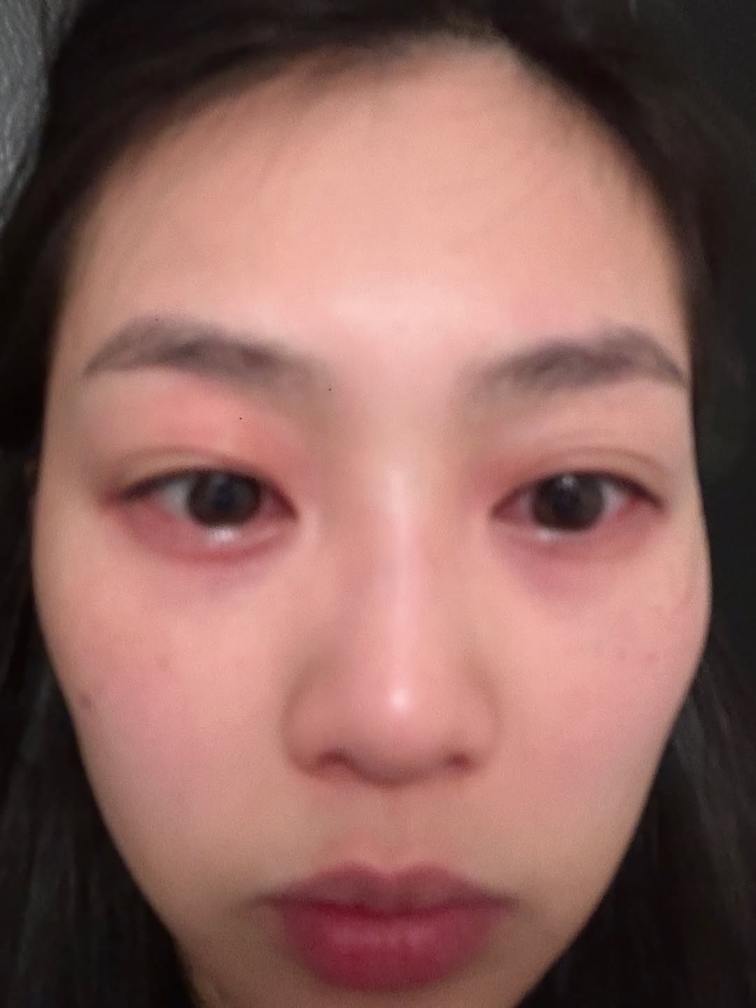 娛樂-郭柏妍-食物中毒-食物敏感-致敏原