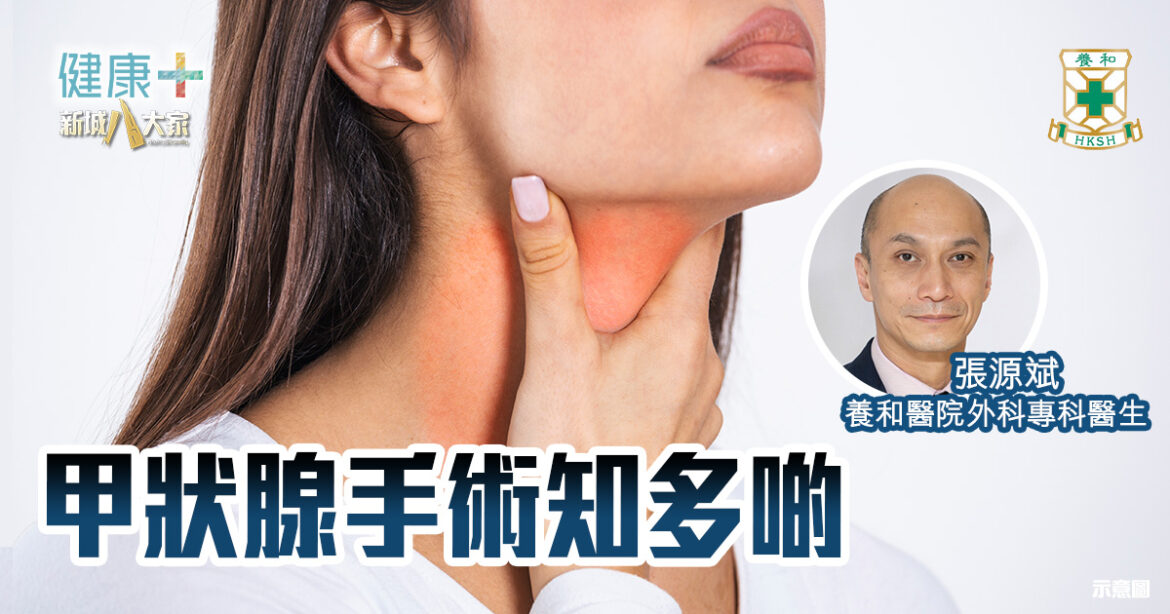 甲狀腺手術知多啲｜養和醫院外科專科醫生張源斌醫生