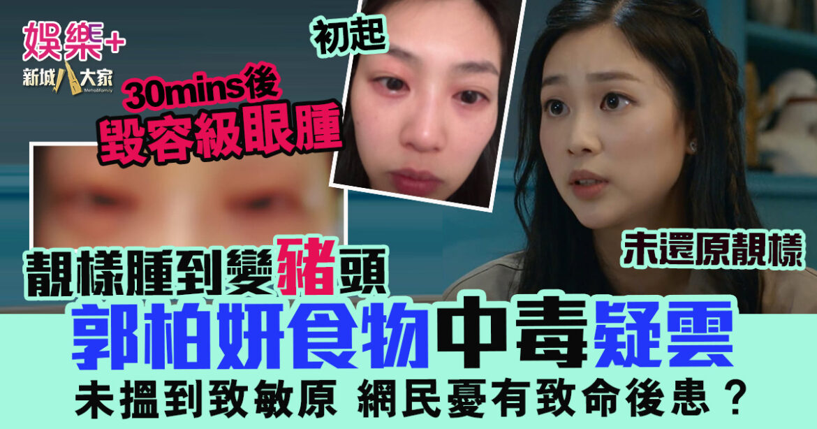 女神變豬頭 郭柏妍食物中毒疑雲　未搵到致敏原 網民憂有致命危機