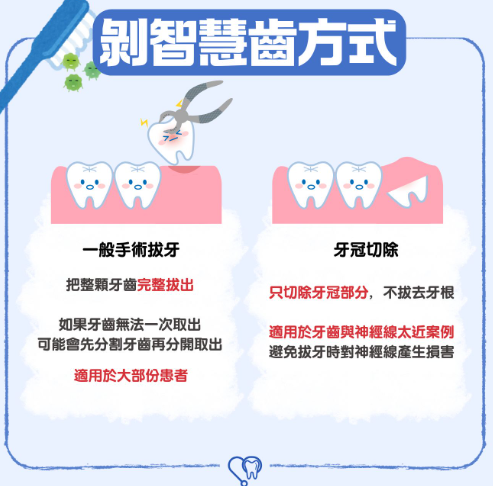 智慧齒-手術-伍裕彤醫生1