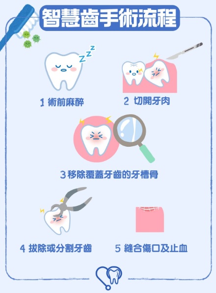 智慧齒-手術-伍裕彤醫生2