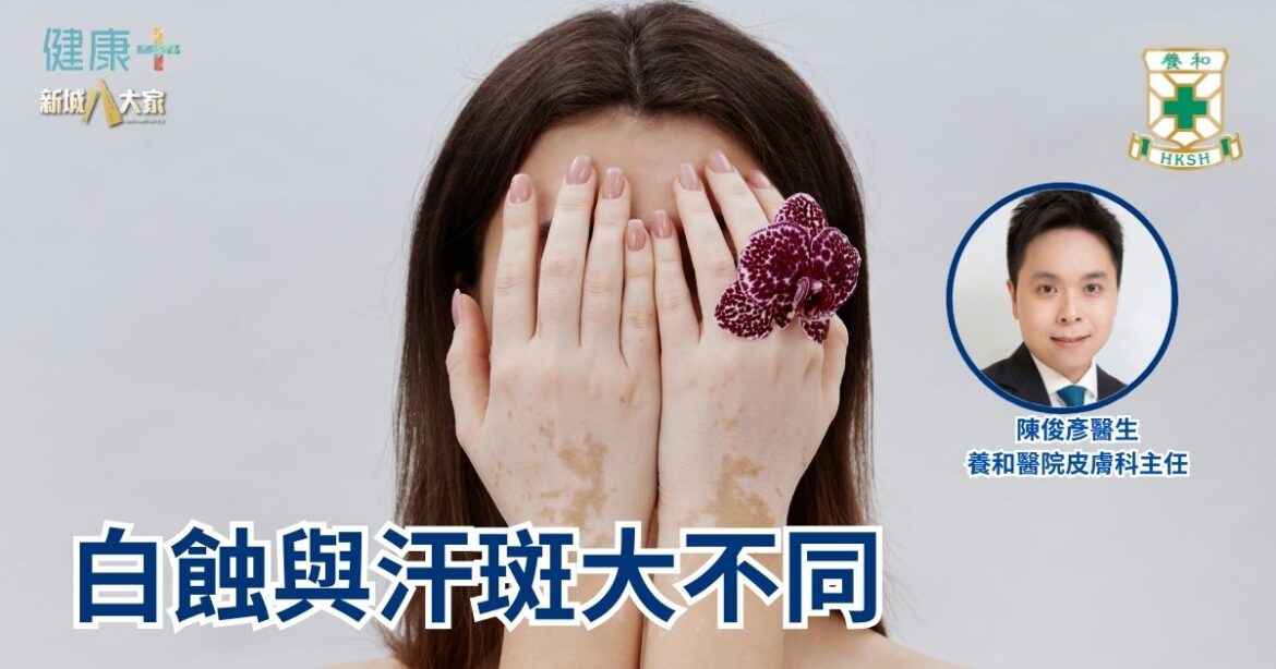白蝕與汗斑大不同｜養和醫院皮膚科主任陳俊彥醫生