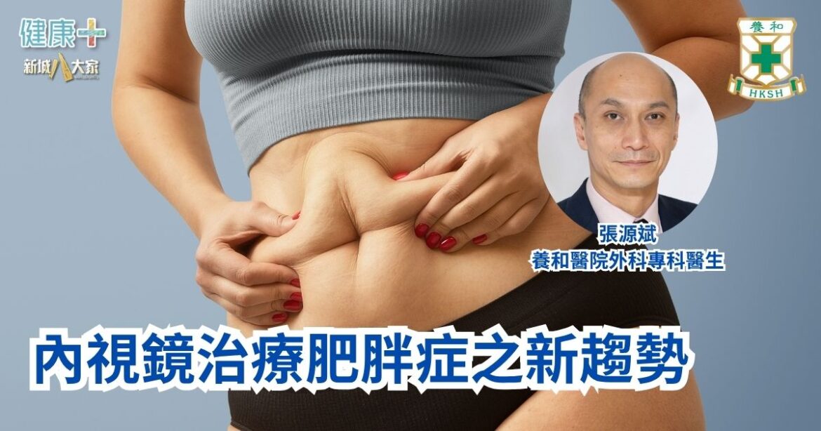 內視鏡治療肥胖症之新趨勢｜養和醫院外科專科醫生張源斌醫生