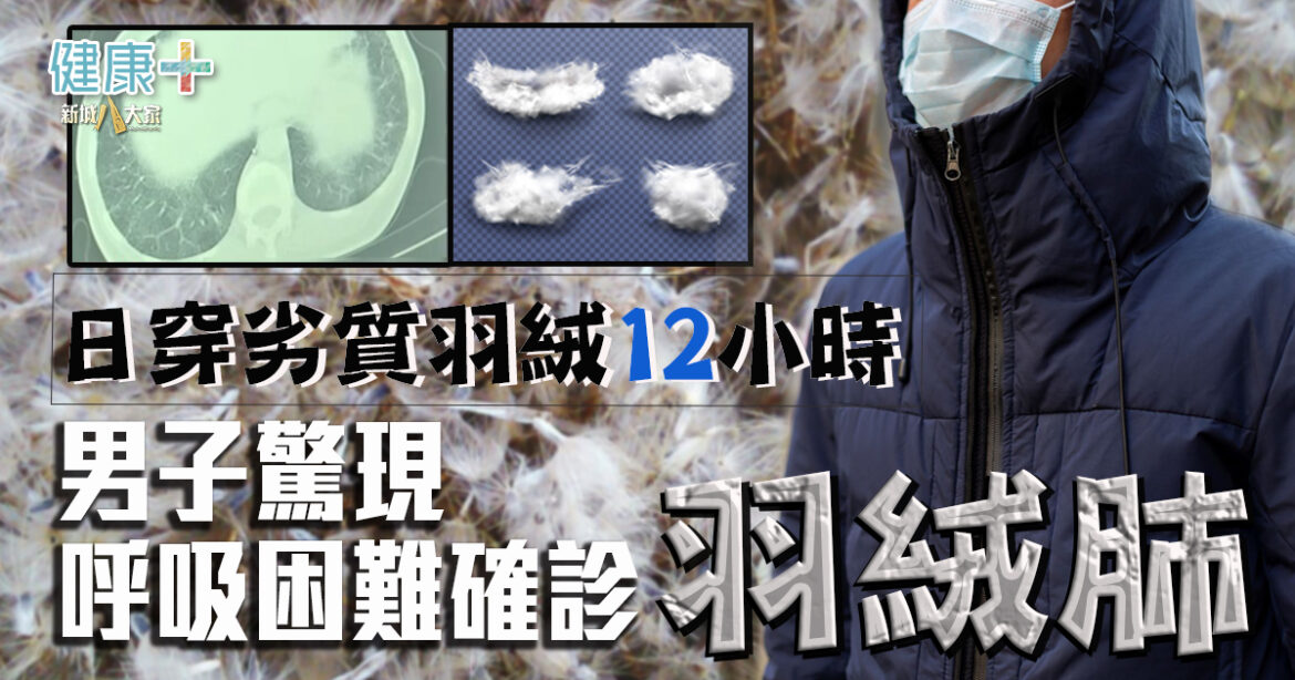 日穿劣質羽絨12小時  男子驚現呼吸困難確診「羽絨肺」
