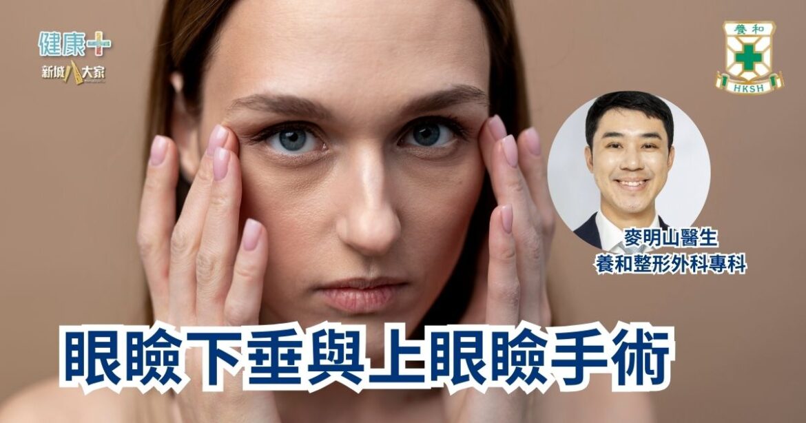 眼瞼下垂與上眼瞼手術｜養和整形外科專科麥明山醫生