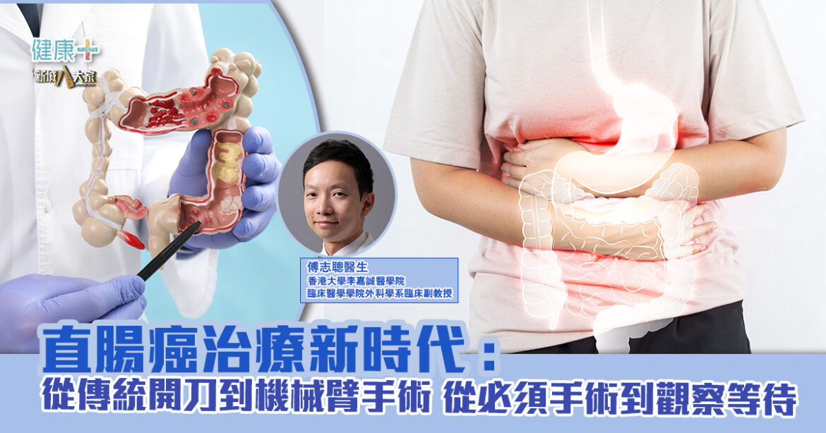 直腸癌治療新時代：從傳統開刀到機械臂手術  從必須手術到觀察等待