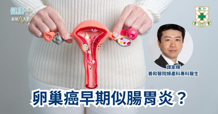 卵巢癌早期似腸胃炎？｜養和醫院婦產科專科醫生譚家輝醫生