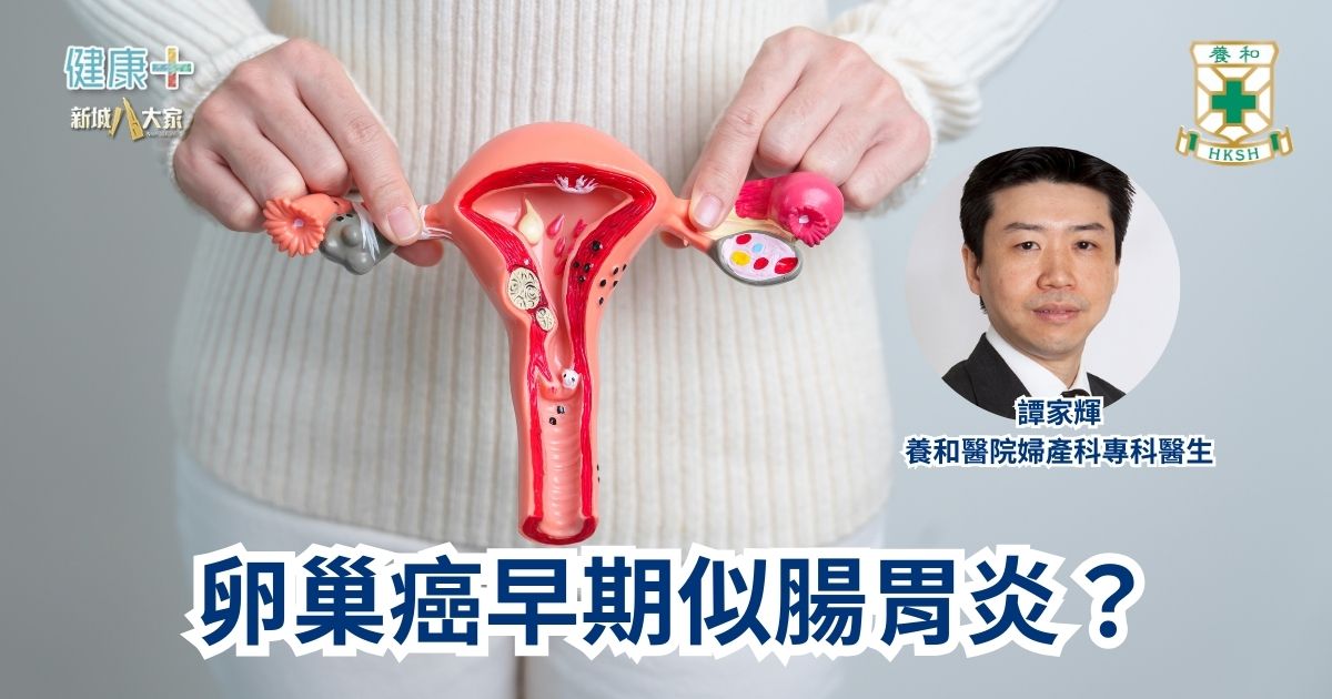 卵巢癌早期似腸胃炎？｜養和醫院婦產科專科醫生譚家輝醫生