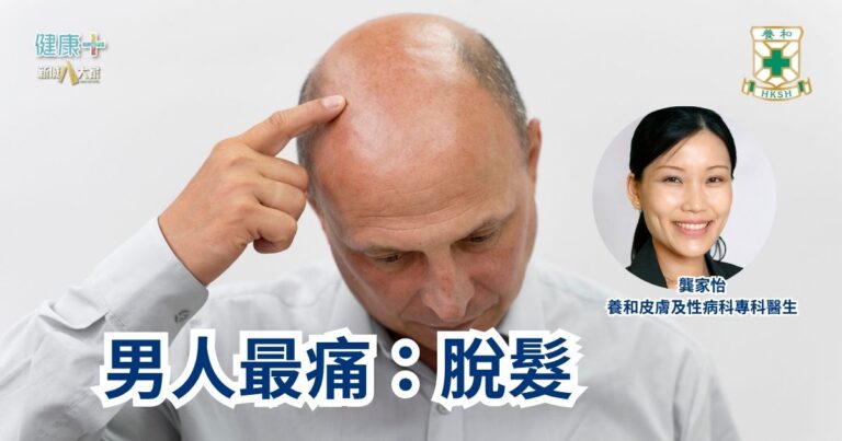 男人最痛：脫髮｜養和皮膚及性病科專科醫生龔家怡醫生