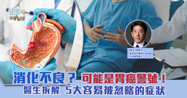 消化不良？可能是胃癌警號！  醫生拆解5大容易被忽略的症狀